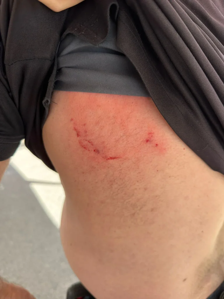 מאבטח הותקף במתקן ההגירה; הופסקה קבלת הקהל לאריתראים