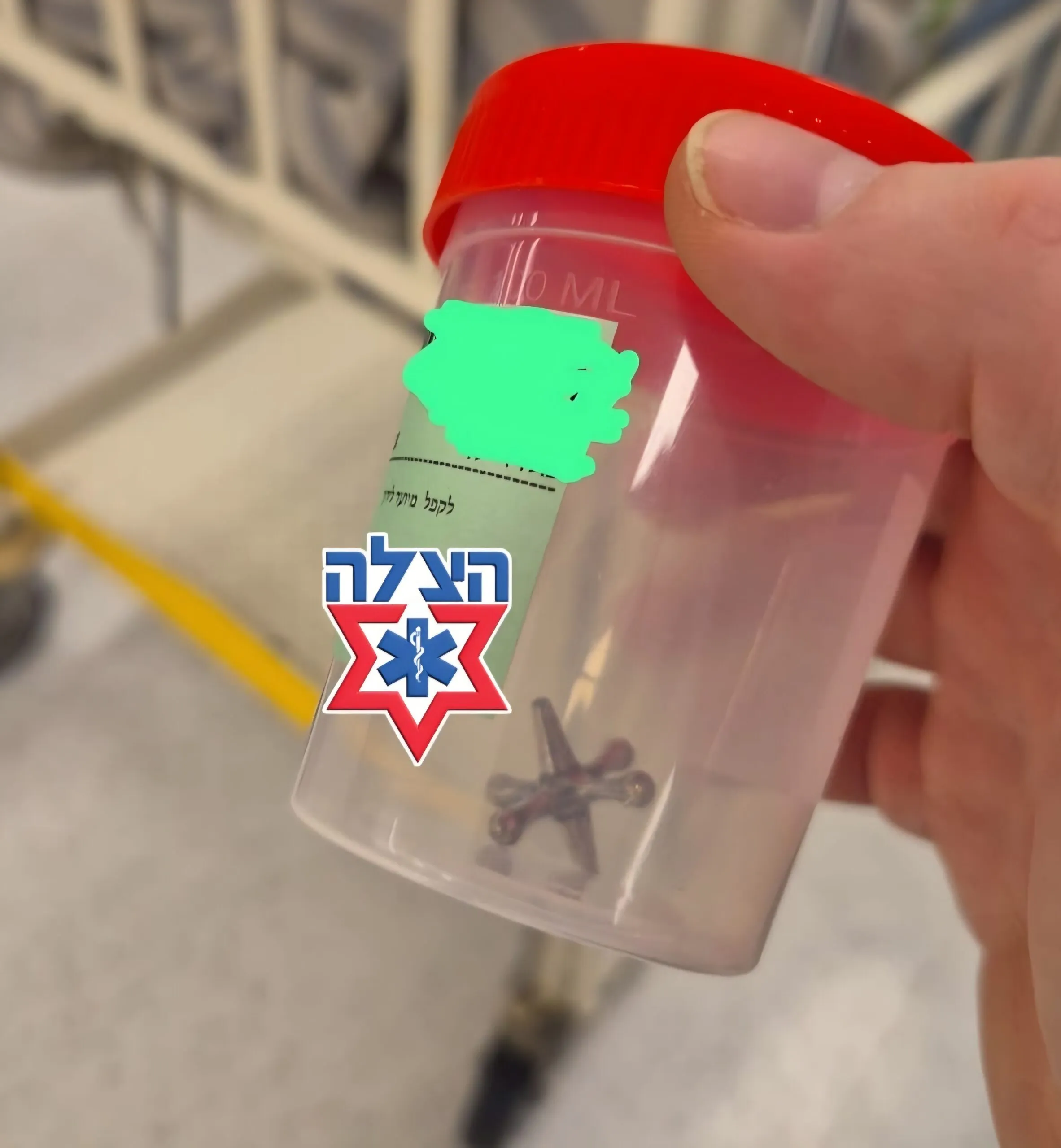 בני ברק זועקת: תינוק נחנק מהמשחק הפופולרי ונכנס לניתוח חירום