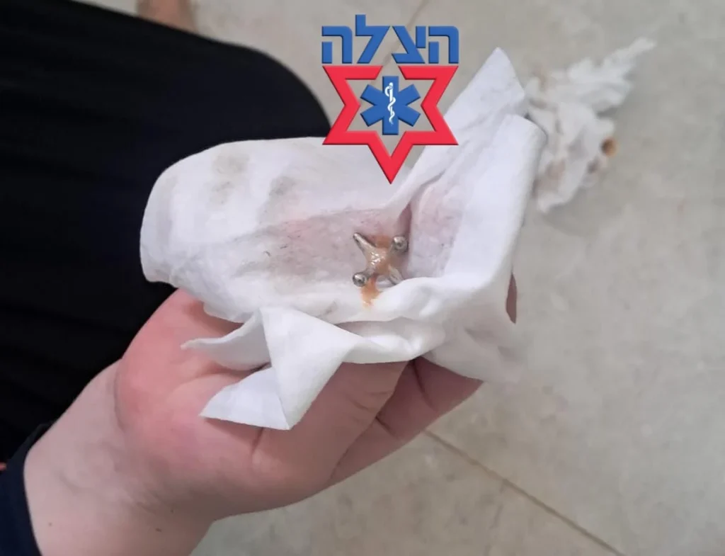 תינוקת כמעט נחנקה מ'ג'אקס'. מתנדב 'הצלה' ביצע היימליך והצילה